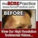 The Acne Practice Coupon Codes & Deals